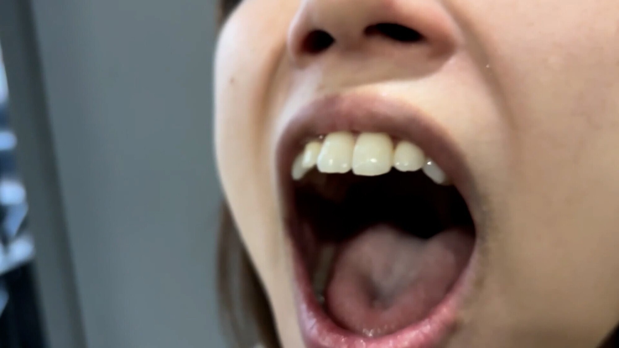 街角で声をかけて口内観察させてもらう オーガニックスーパー勤務 はつみちゃん