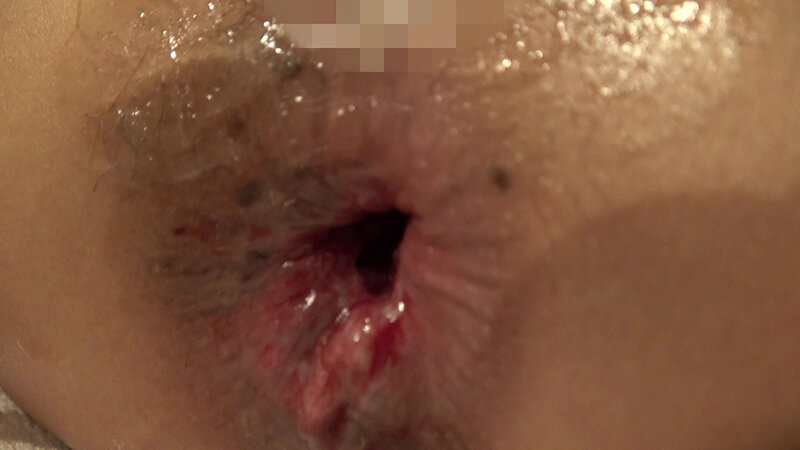 重度アナル依存症の女教師 西山真由子