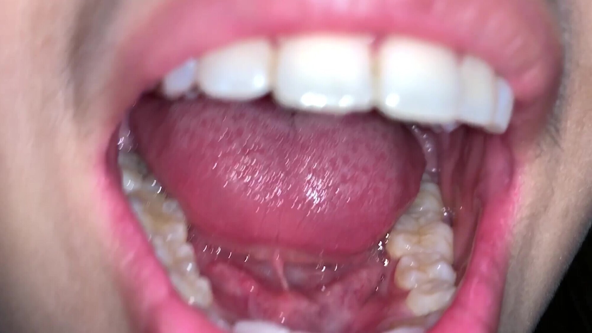 【個人撮影】バックパッカー裏垢女子の口内がエロい!!るい